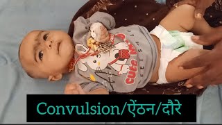 Convulsions  बच्चो में मिर्गी के दौरे  seizure convulsion [upl. by Anilatac]