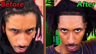 How to give Yourself a TAPERED HAIRLINE [upl. by Shaughnessy]