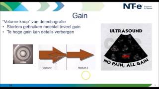 Webinar knoppologie knobology in de echografie [upl. by Draude631]