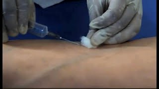 Phlebotomy venipuncture procedure Dr Sanjay D Deshmukh MD [upl. by Thinia627]