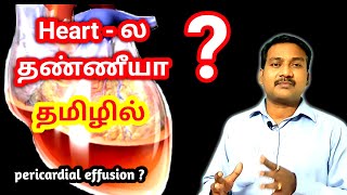 Pericardial Effusion in tamil  Heart Problem in tamil  ECG ECHO in tamil [upl. by Domenic231]