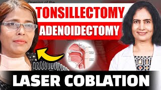 Laser Coblation Tonsillectomy and Adenoidectomy [upl. by Earlene]