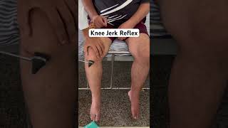 Knee Jerk Reflex L3L4 there is exaggerated extension of the left knee knee reflexes reels [upl. by Jacinto]