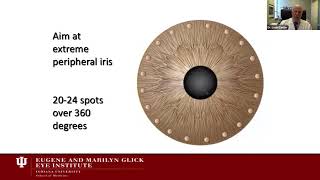 Lecture Glaucoma Surgery An Evolving Art and Science [upl. by Llenehs52]