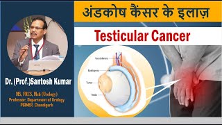 Testicular tumor and Cancerअण्डकोष कैंसर का इलाज DrProfSantosh Kumar PGI [upl. by Nahtnaoj]