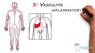 Rheumatology – Polyarticular Pain By Lori Albert MD [upl. by Rochelle]