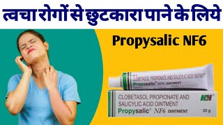 Propsaslic NF6 Ointment Uses Benefits And Side Effects In hindi  Clobetasol Propionate Cream [upl. by Airdnassac]