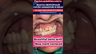 ब्रिजिंग के माध्यम से नए दांत लगाने का सबसे अच्छा तरीकाDental Bridging for fixing new teeth [upl. by Bach945]