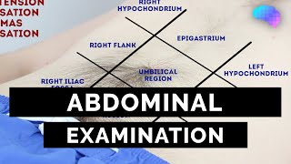 Abdominal Examination  OSCE Guide Latest  UKMLA  CPSA [upl. by Rolecnahc854]