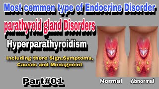 Hyperparathyroidism  Parathyroid gland Disorder By AbuBakar Med Plus [upl. by Marchak]