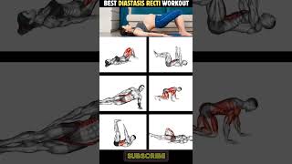 6 Best Diastasis Recti Workout Routine workout diastasisrectiexercises [upl. by Anthia190]