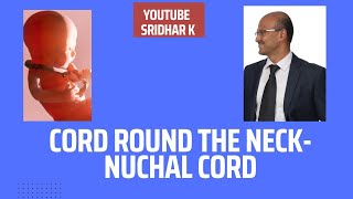 Cord round the neckNuchal cord Should we be worried cordroundneck cordlooping nuchalcord [upl. by Dranrev]