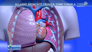 Allarme bronchite cronica come curarla [upl. by Siurtemed]