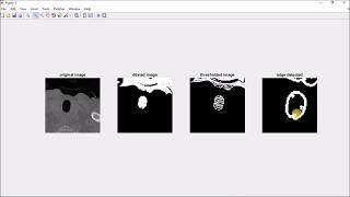 Working with MATLAB on DICOM images An easy tutorial for beginners [upl. by Lekzehcey195]