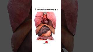 Endoscopic Ultrasound procedure  Short Animated Video [upl. by Butler]