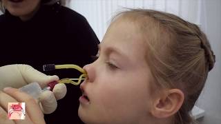 YAMIK procedure  a method for topical treatment of sinusitis [upl. by Jakob]