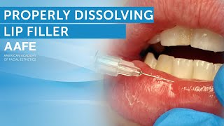 How To Dissolve Lip Filler  AAFE [upl. by Gawain459]