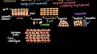 Neoplasia [upl. by Gardiner]