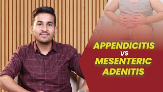 Appendicitis Vs Mesenteric Adenitis  Dr B Padam Kumar [upl. by Peper243]