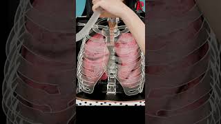 The Truth About Incentive Spirometry Doctor Explained [upl. by Torres]