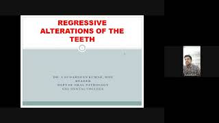 Regressive alterations of teeth [upl. by Nitsej]