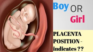 Placenta Position really predict the Baby gender  II Posterior and Anterior Placenta positions [upl. by Elamor]