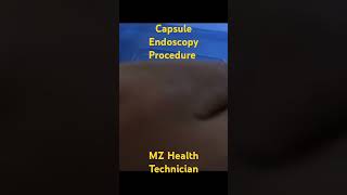 Capsule Endoscopy Procedure [upl. by Laetitia782]