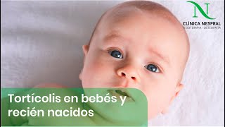 Tortícolis en bebes y niños recién nacidos 👶🏻 Fisioterapia Pediátrica Gijón Asturias [upl. by Auerbach]