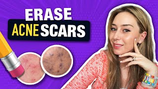 How to Treat amp Fade Acne Scars like a Dermatologist  Dr Shereene Idriss [upl. by Egdirdle]