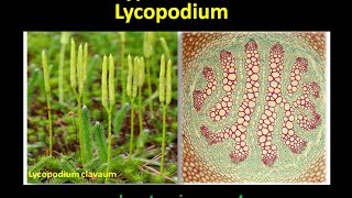 Different types of Steles found in Lycopodium [upl. by Thad281]