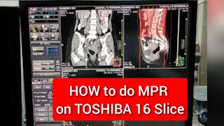 CT Reconstruction Protocol on Toshiba 16 Slice [upl. by Campos795]