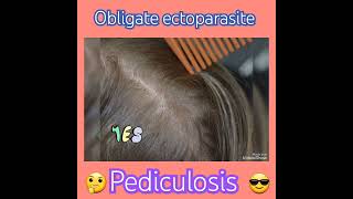 PediculosisHead lice infestationPediculus humanus capitis👍ectoparasites👌👍Parasitology👍✅ [upl. by Durst197]