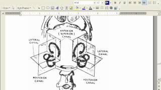 MOTOR CNS Part 12 د  مجدى صبرى [upl. by Averell]