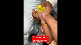 Intravenous cannulation  cannula cannulation trending shorts SMpharmacy plzz subscribe [upl. by Aksehcnarf]