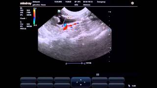 Ultrasonography Left kidney of the dog [upl. by Ameg]