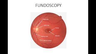 HOW TO DO FUNDOSCOPY OR OPHTHALMOSCOPY [upl. by Nwotna]