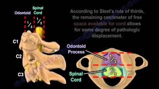 Cervical Spine Injury Steels Rule Of Thirds  Everything You Need To Know  Dr Nabil Ebraheim [upl. by Loferski]