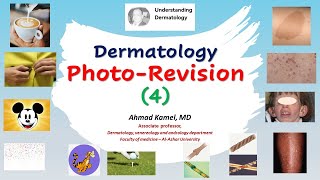 Dermatology Photo Revision 4 [upl. by Ayikur423]