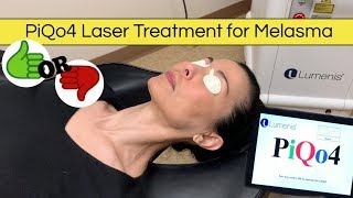 PiQo4 Laser Treatment For Melasma Did It Work For Me [upl. by Rhoads]