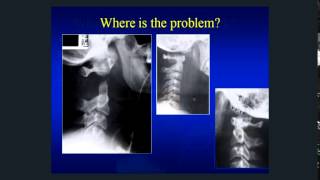 Neck Pain How to Treat It and How to Beat It [upl. by Jo]