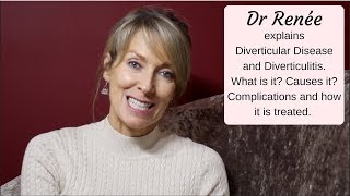 Diverticular Disease  what it is and what are the many complications [upl. by Godliman]