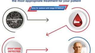 Guardant360’s Comprehensive Genotyping in NSCLC [upl. by Ahsiya]