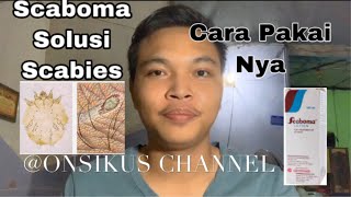 Cara Pemakaian Scaboma OBAT OLES Untuk KudisScabies [upl. by Nodnorb839]