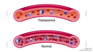 thalassemia test  anemia tests hematology diseases سلسلة فيديوهات علم المختبرات الطبية [upl. by Natala957]