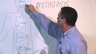 How Cancer Spreads Metastasis  Michael Henry PhD [upl. by Harmonia]