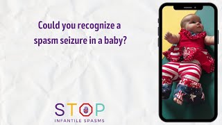 Could you recognize a spasm seizure in a baby [upl. by Nosredneh]