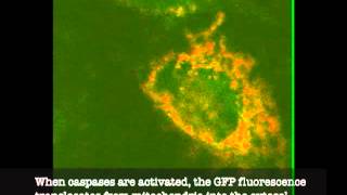 Cells undergoing cell death by apoptosis [upl. by Hgierb]