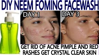 Neem Facewash For Acne And Pimples  How To Make Neem Face wash At Home  Neem Face Wash Homemade [upl. by Uchish326]