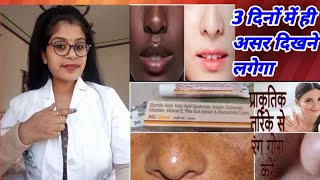 Doctor Review NG Glow Cream  Heal ampCure Glow Cream Skin whitening cream usesampside review inhindi [upl. by Lauri]