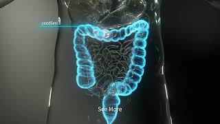 OMOM Colon Capsule Endoscopy System [upl. by Eiramasil490]